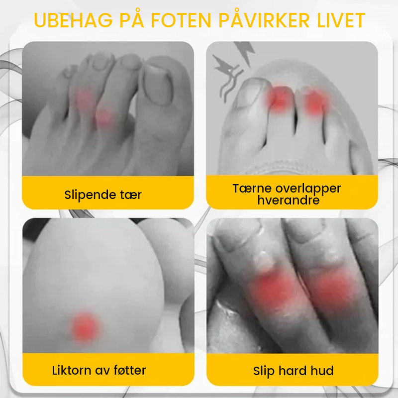 Silikon Tåbeskytter - Anti-friksjonskomfort | Transparent