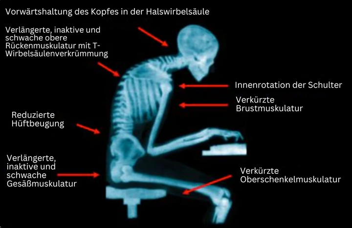 Holdningskorrigerer med EMS-teknik för Bättre Rygghelse
