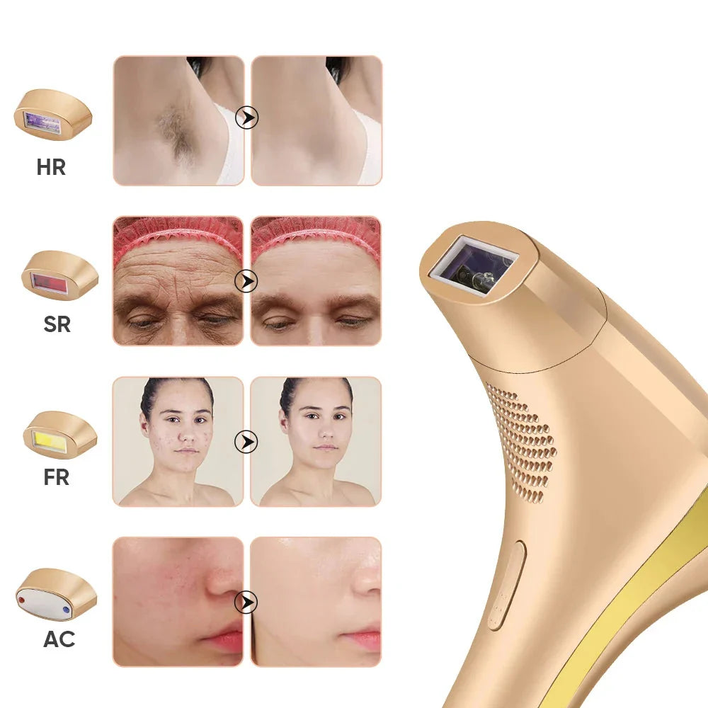Unisex Laser Epilator för Hårfjerning Ansikt och Kropp